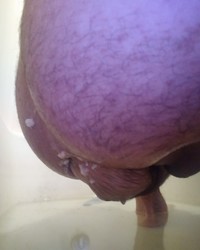 photo-thumb