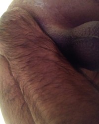 photo-thumb