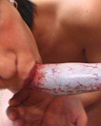 photo-thumb