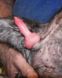 photo-thumb