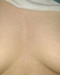 photo-thumb