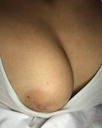 photo-thumb