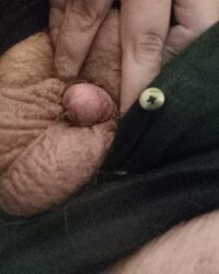 photo-thumb
