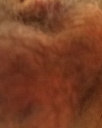 album-cover