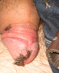photo-thumb